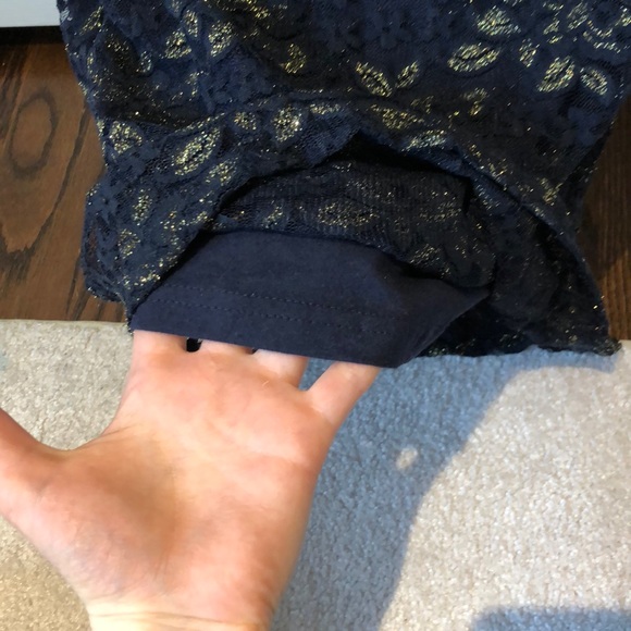 Forever 21 Blue Gold Lace Dress - Picture 8 of 8